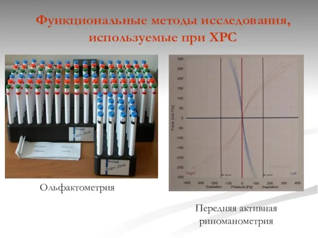 Функциональные методы исследования, используемые при ХРС Ольфактометрия Передняя активная риноманометрия