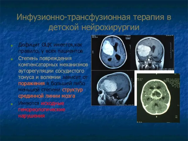 Инфузионно-трансфузионная терапия в детской нейрохирургии Дефицит ОЦК имеется,как правило, у всех