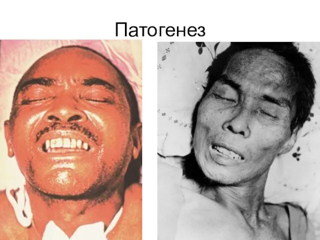 Патогенез