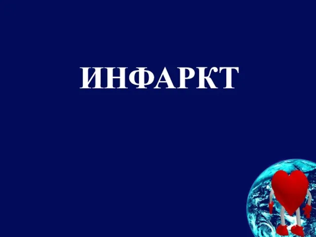 ИНФАРКТ