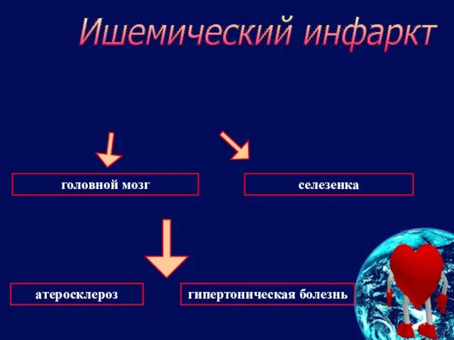 Ишемический инфаркт селезенка головной мозг атеросклероз гипертоническая болезнь