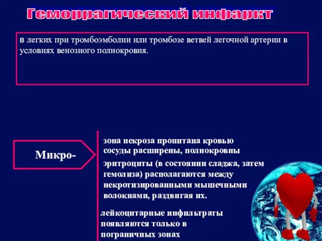 в легких при тромбоэмболии или тромбозе ветвей легочной артерии в условиях