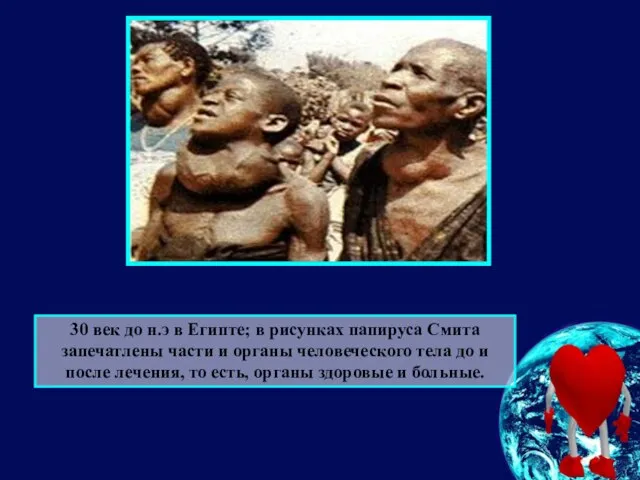 30 век до н.э в Египте; в рисунках папируса Смита запечатлены