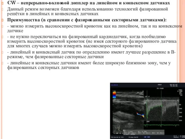 CW – непрерывно-волновой допплер на линейном и конвексном датчиках Данный режим