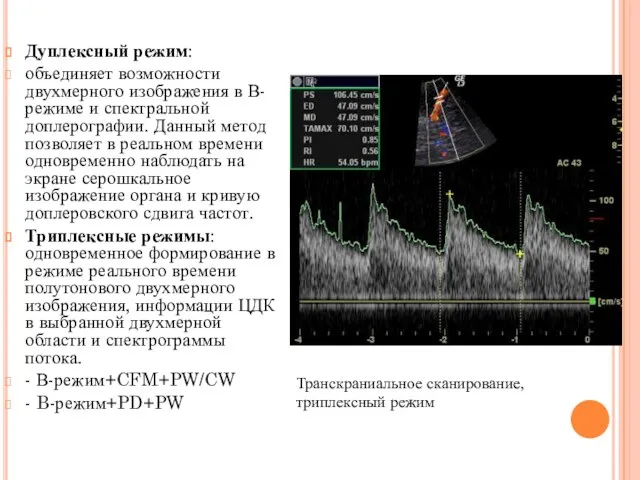 Дуплексный режим: объединяет возможности двухмерного изображения в В-режиме и спектральной доплерографии.