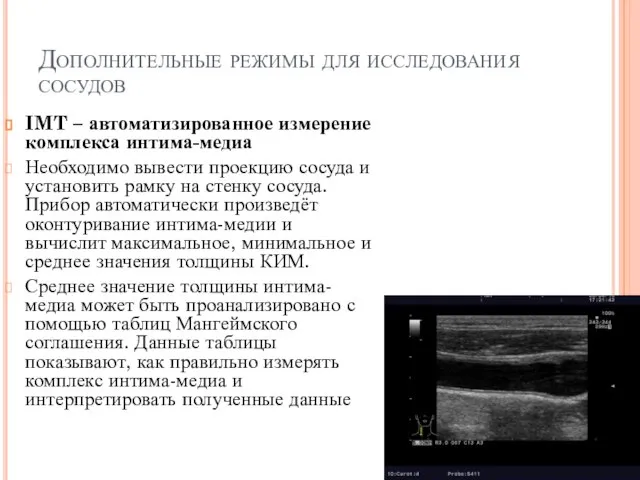 Дополнительные режимы для исследования сосудов IMT – автоматизированное измерение комплекса интима-медиа