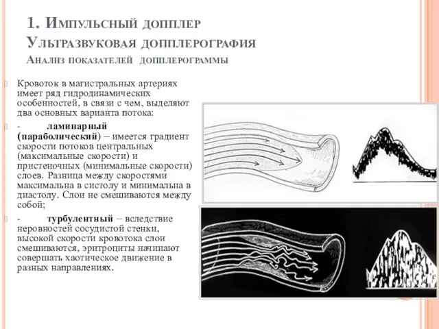 1. Импульсный допплер Ультразвуковая допплерография Анализ показателей допплерограммы Кровоток в магистральных