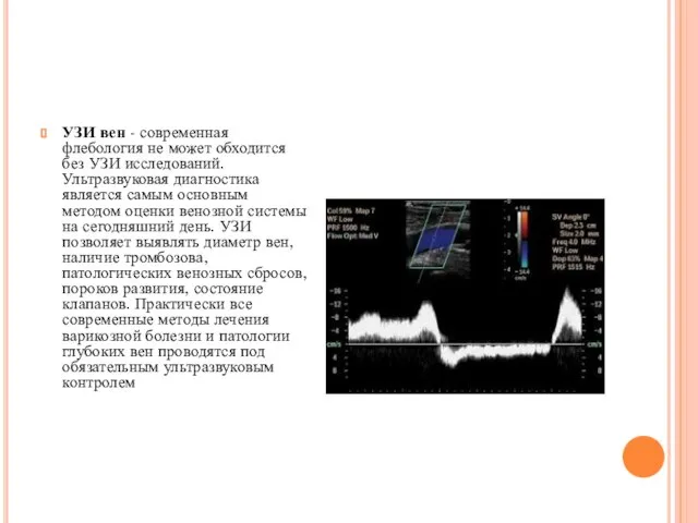 УЗИ вен - современная флебология не может обходится без УЗИ исследований.