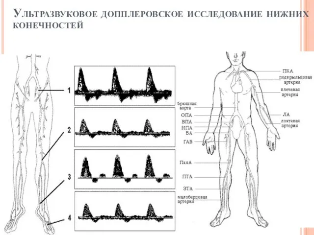 Ультразвуковое допплеровское исследование нижних конечностей