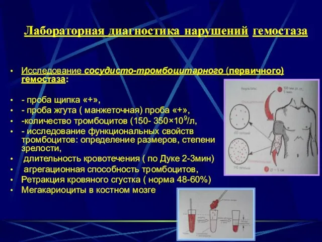 Лабораторная диагностика нарушений гемостаза Исследование сосудисто-тромбоцитарного (первичного)гемостаза: - проба щипка «+»,