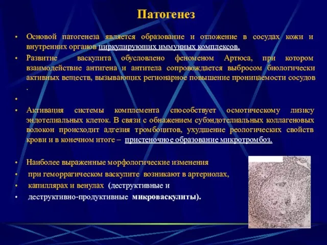 Патогенез Основой патогенеза является образование и отложение в сосудах кожи и