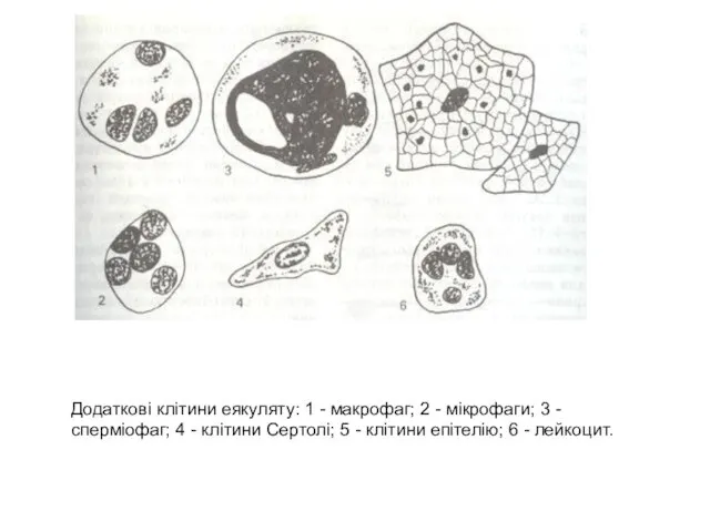 Додаткові клітини еякуляту: 1 - макрофаг; 2 - мікрофаги; 3 -