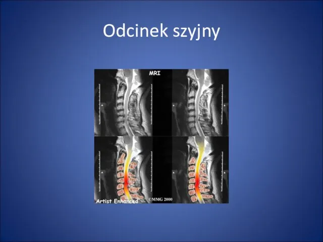 Odcinek szyjny