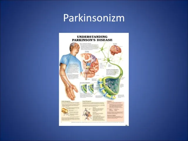 Parkinsonizm