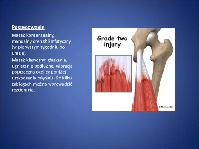 Postępowanie Masaż konsensualny, manualny drenaż limfatyczny (w pierwszym tygodniu po urazie).