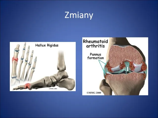 Zmiany