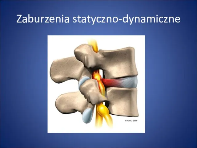 Zaburzenia statyczno-dynamiczne