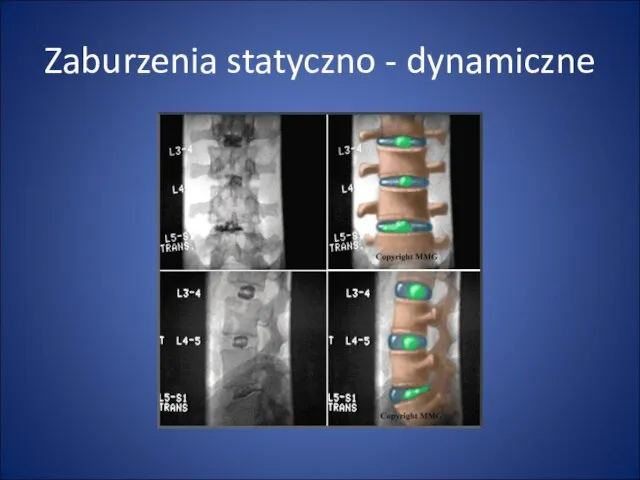 Zaburzenia statyczno - dynamiczne