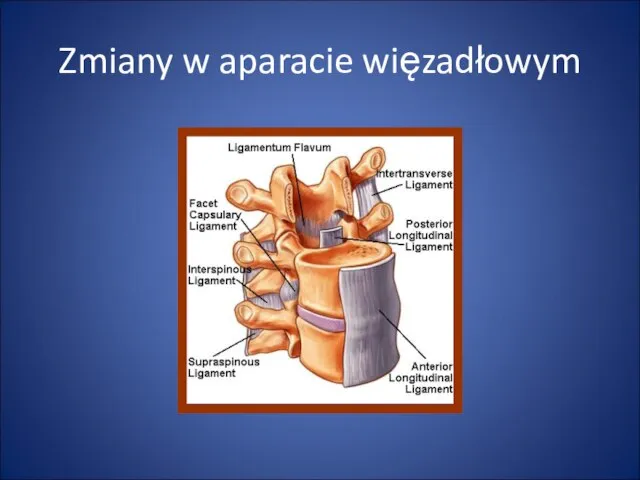 Zmiany w aparacie więzadłowym