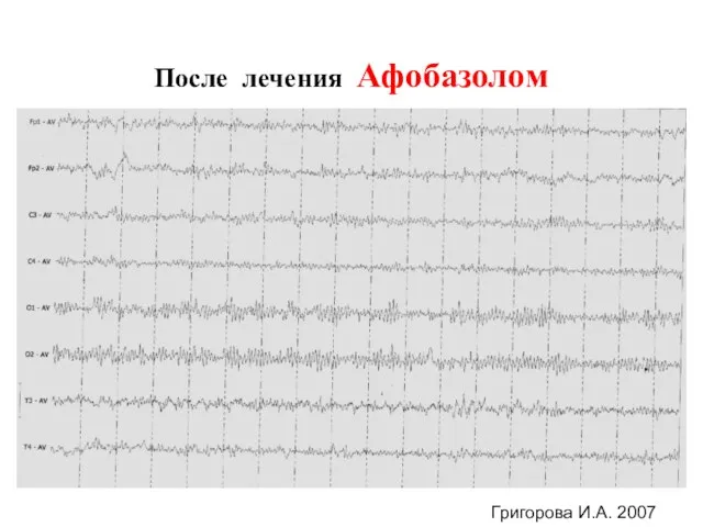 После лечения Афобазолом Григорова И.А. 2007