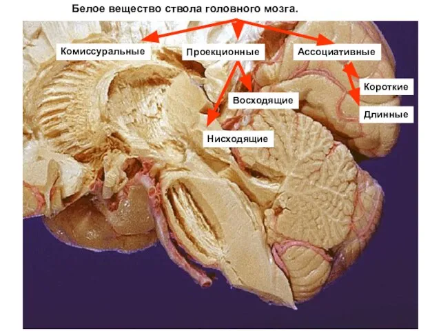 Белое вещество ствола головного мозга. Комиссуральные Восходящие Ассоциативные Проекционные Длинные Короткие Нисходящие