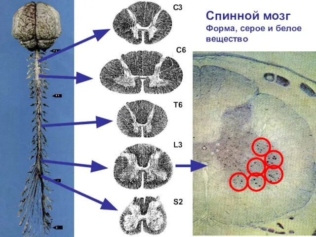 С3 С6 Т6 L3 S2 Спинной мозг Форма, серое и белое вещество