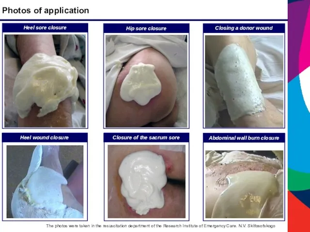 Photos of application Hip sore closure Heel wound closure Closing a