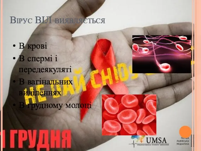 Вірус ВІЛ виявляється В крові В спермі і передеякуляті В вагінальних виділеннях В грудному молоці