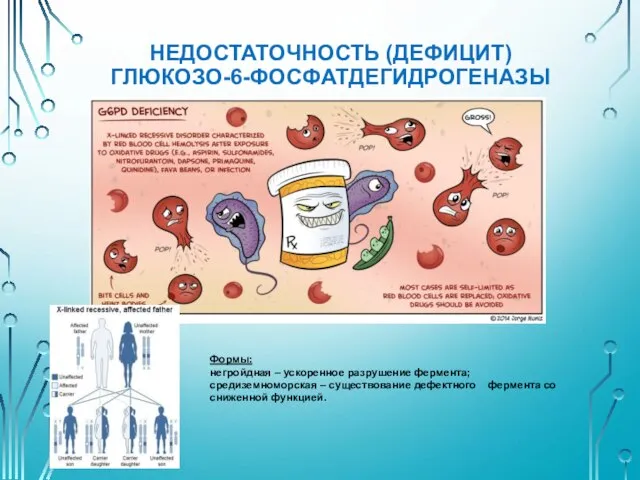 НЕДОСТАТОЧНОСТЬ (ДЕФИЦИТ) ГЛЮКОЗО-6-ФОСФАТДЕГИДРОГЕНАЗЫ Формы: негройдная – ускоренное разрушение фермента; средиземноморская –