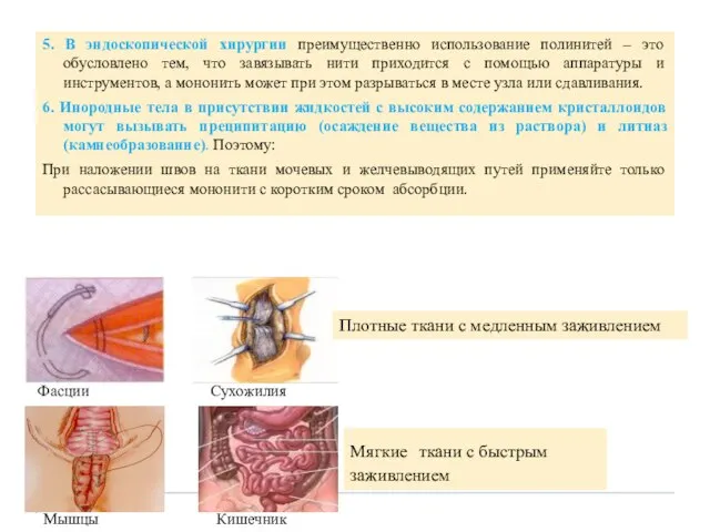 5. В эндоскопической хирургии преимущественно использование полинитей – это обусловлено тем,