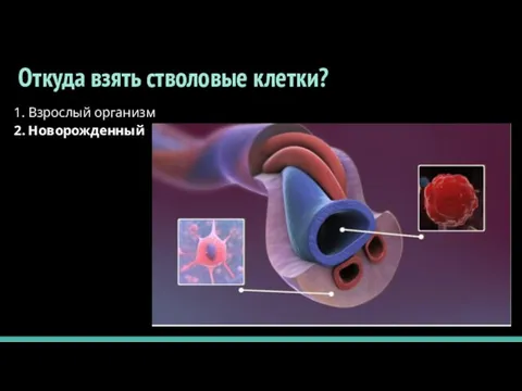 Откуда взять стволовые клетки? 1. Взрослый организм 2. Новорожденный