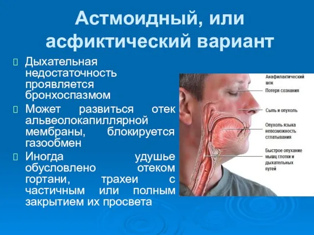 Астмоидный, или асфиктический вариант Дыхательная недостаточность проявляется бронхоспазмом Может развиться отек