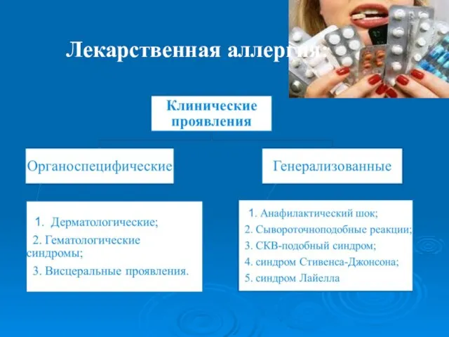 Лекарственная аллергия: