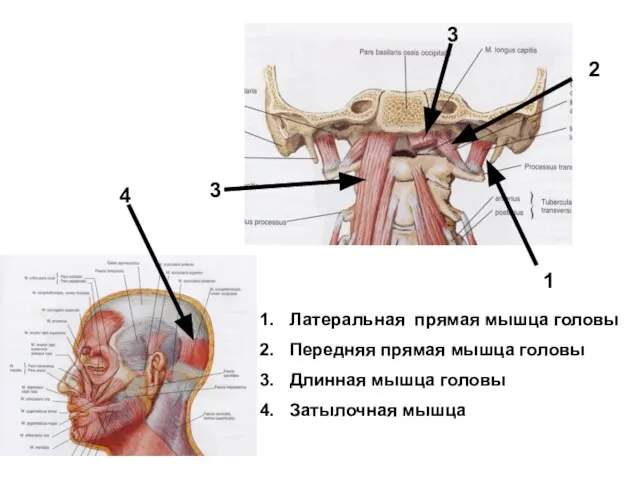 Латеральная прямая мышца головы Передняя прямая мышца головы Длинная мышца головы