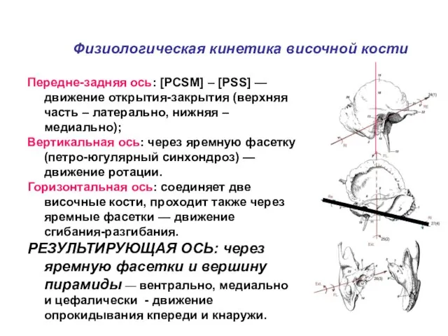 Физиологическая кинетика височной кости Передне-задняя ось: [PCSM] – [PSS] — движение