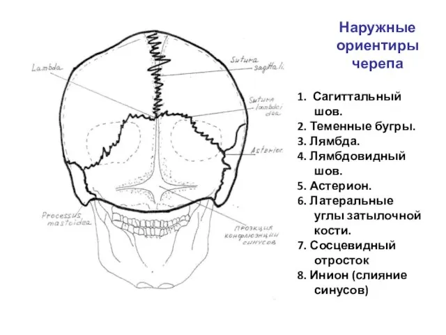 Наружные ориентиры черепа 1. Сагиттальный шов. 2. Теменные бугры. 3. Лямбда.