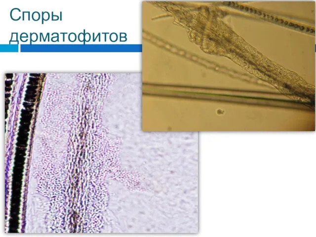 Споры дерматофитов