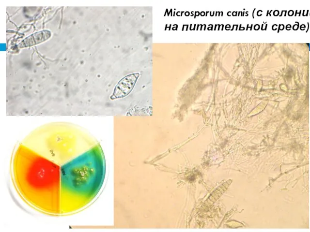 Microsporum canis (с колонии на питательной среде)