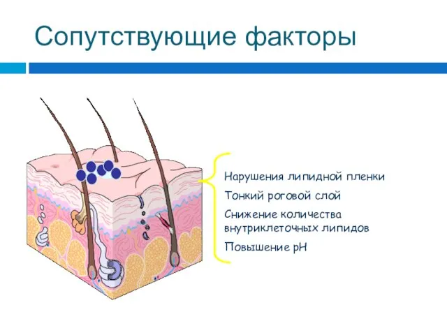 Нарушения липидной пленки Тонкий роговой слой Снижение количества внутриклеточных липидов Повышение pH Сопутствующие факторы
