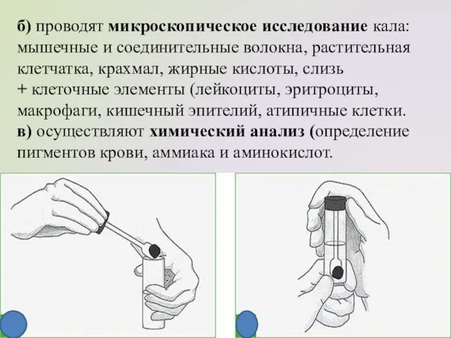 б) проводят микроскопическое исследование кала: мышечные и соединительные волокна, растительная клетчатка,