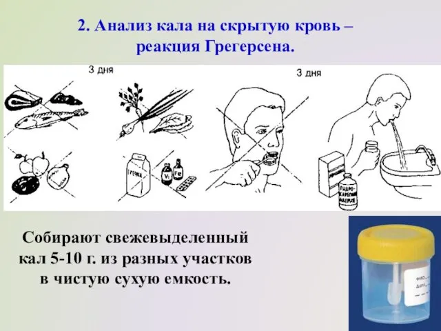 2. Анализ кала на скрытую кровь – реакция Грегерсена. Собирают свежевыделенный