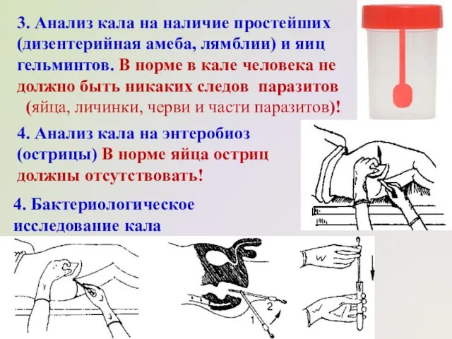 4. Бактериологическое исследование кала 3. Анализ кала на наличие простейших (дизентерийная