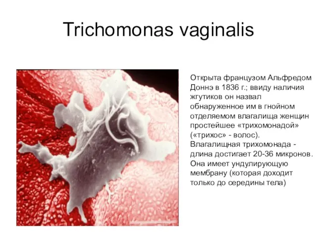 Trichomonas vaginalis Oткрыта французом Альфредом Доннэ в 1836 г.; ввиду наличия