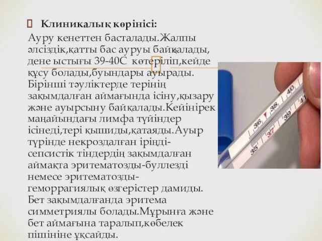 Клиникалық көрінісі: Ауру кенеттен басталады.Жалпы әлсіздік,қатты бас ауруы байқалады,дене ыстығы 39-40С