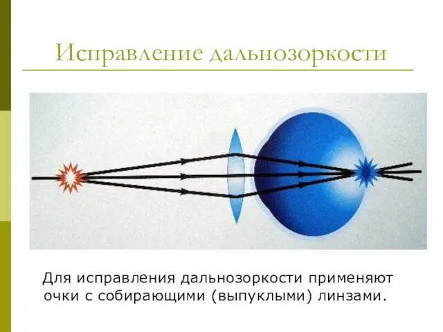 Исправление дальнозоркости Для исправления дальнозоркости применяют очки с собирающими (выпуклыми) линзами.