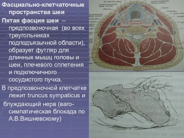 Фасциально-клетчаточные пространства шеи Пятая фасция шеи – предпозвоночная (во всех треугольниках