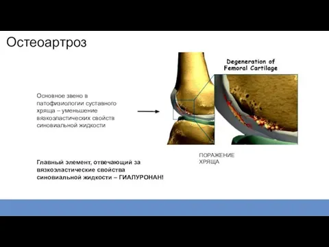 Остеоартроз Основное звено в патофизиологии суставного хряща – уменьшение вязкоэластических свойств