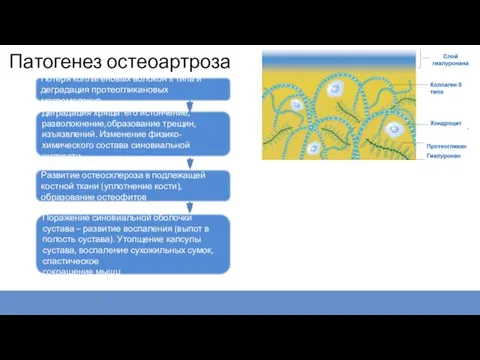 Патогенез остеоартроза Потеря коллагеновых волокон II типа и деградация протеогликановых макромолекул