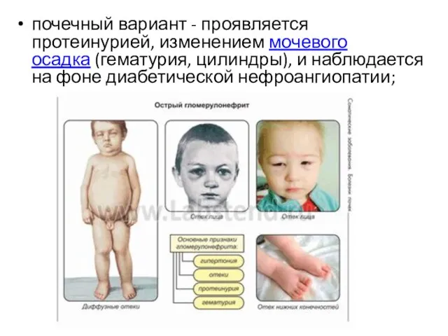 почечный вариант - проявляется протеинурией, изменением мочевого осадка (гематурия, цилиндры), и наблюдается на фоне диабетической нефроангиопатии;