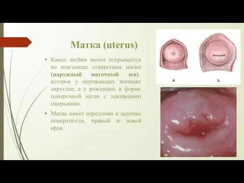 Матка (uterus) Канал шейки матки открывается во влагалище отверстием матки (наружный